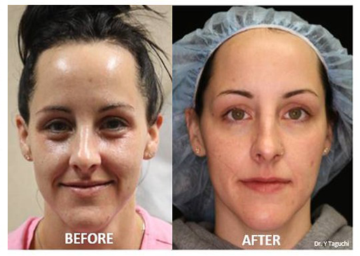 votiva-before-after-photos